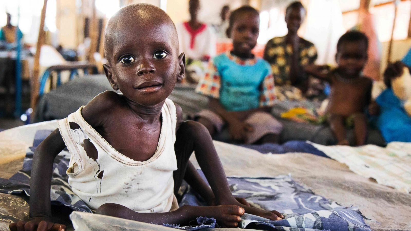 South Sudan Faces Worsening Hunger Crisis as Conflict Deepens, Millions at Risk of Malnutrition