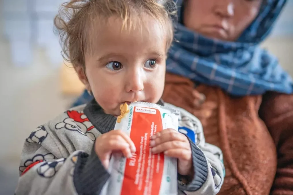 Malnourished Children in Badakhshan