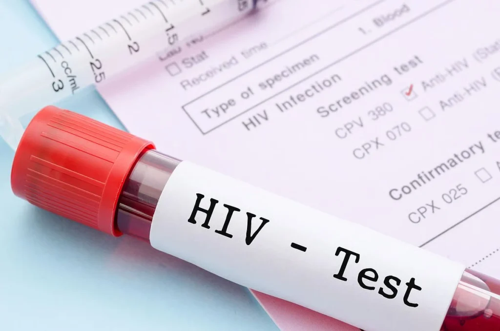 Islamabad HIV cases media reporting debate diplomacy context